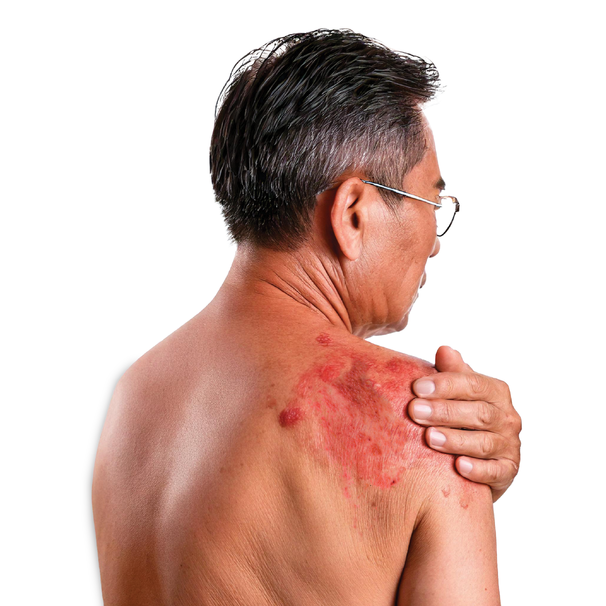 Body Composition Package