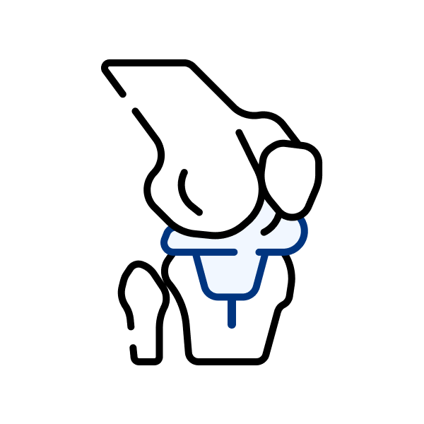 Total Knee Replacement